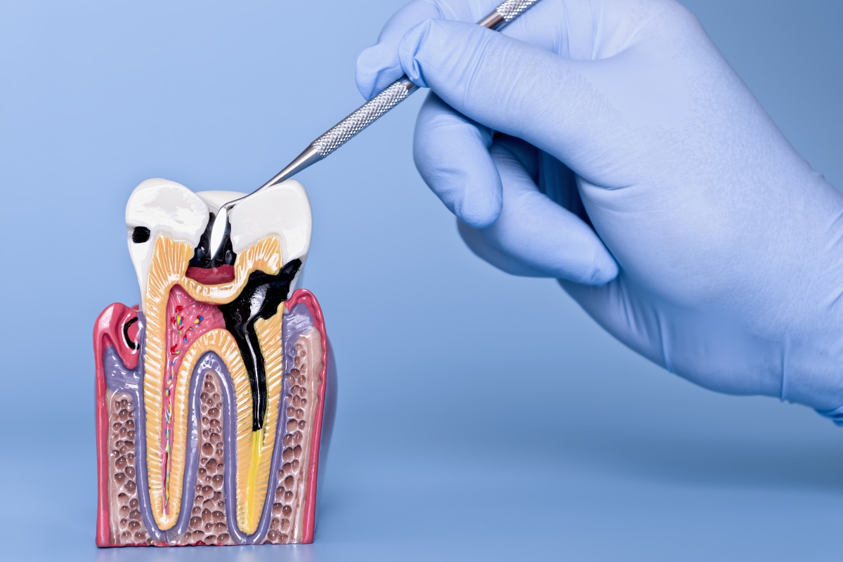 Emergency Dentist Justin